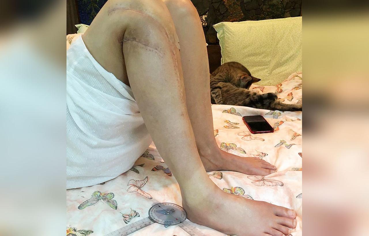 Ashley Judd Posts Gruesome Video Of Leg Injury That Almost Killed Her