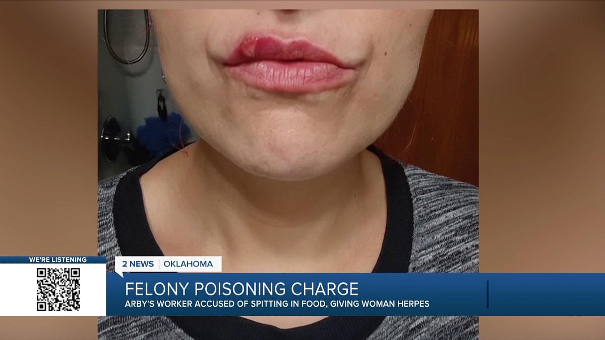 Church said her lips began to flair up, worrying her. 