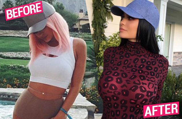 //kylie jenner boob job rumors online backlash