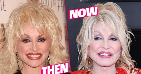 Dolly Parton Smiling Closeup 20 Years Apart Plastic Surgery