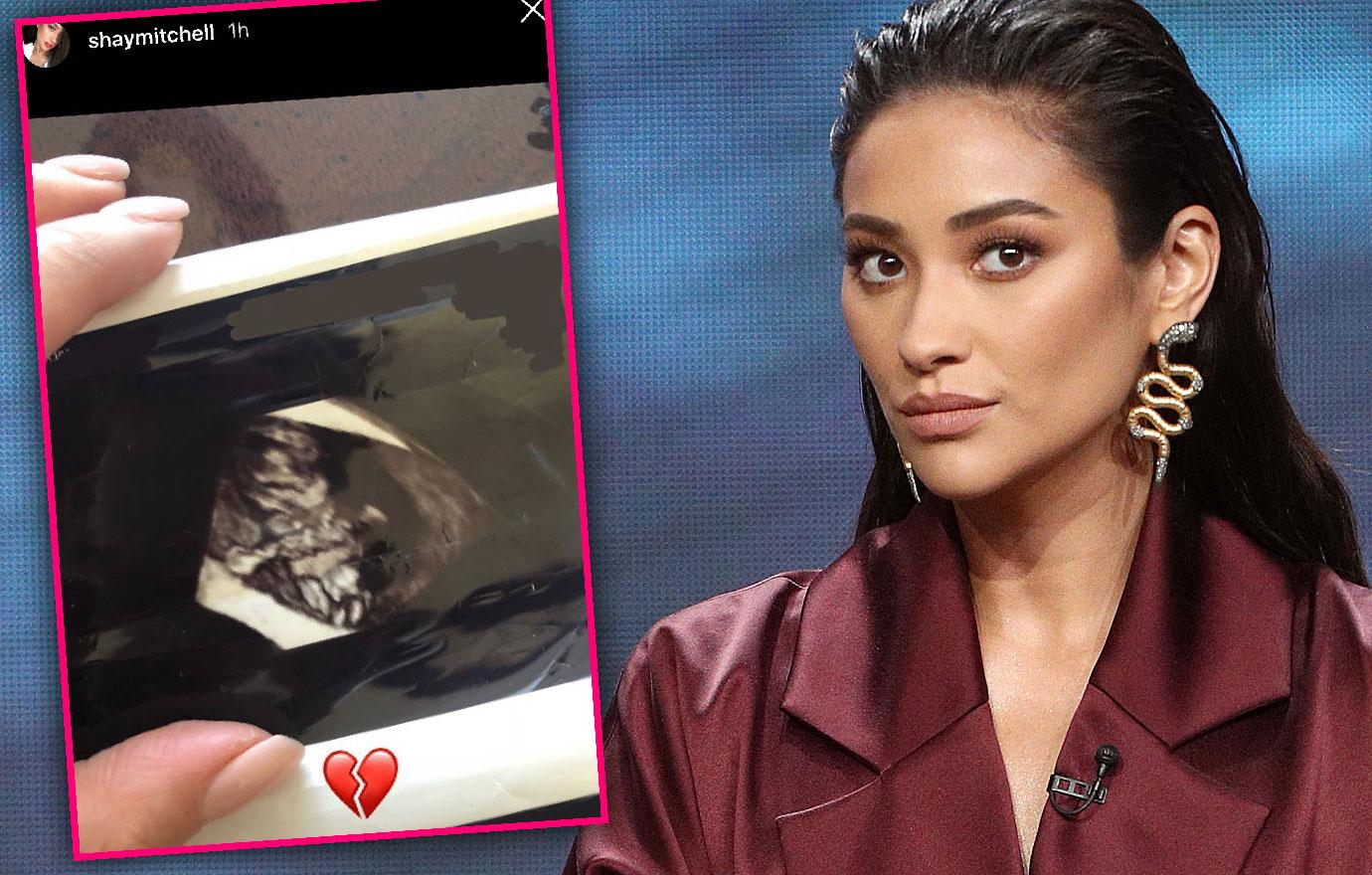 Pretty Little Liars Star Shay Mitchell Suffers A Miscarriage 5323