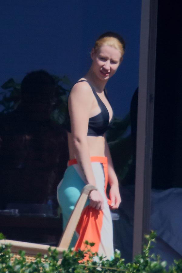 //iggy azalea boob job breast agumentation top doctor claims