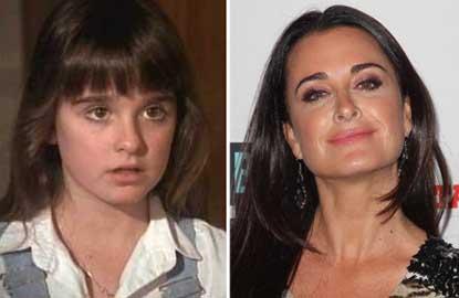 //kyle richards child star plastic surgery