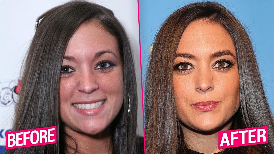Jersey Shore' Cast's Shocking Plastic Surgery Transformations Revealed