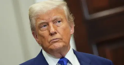 Donald Trump Diagnosed with 'Weak Veins' After 'Swollen Ankles' Pics