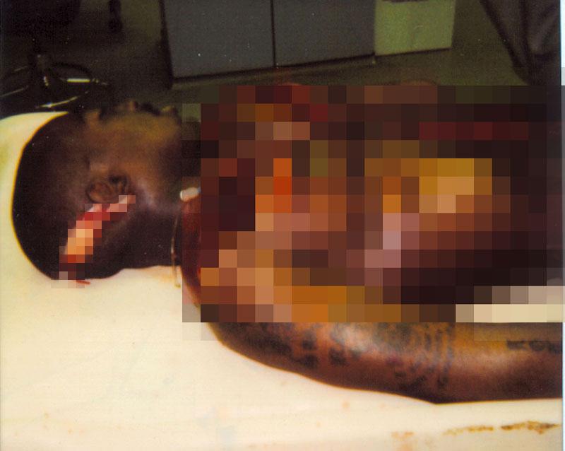 celebrity autopsy secrets photos