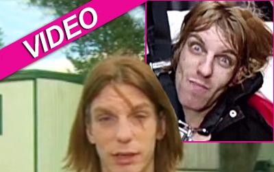 //freddy sharp bathsalt cnn