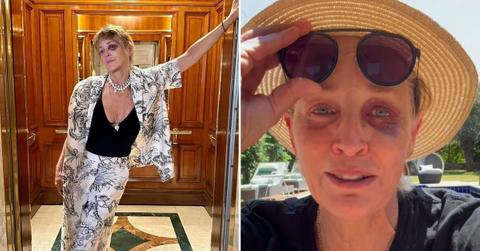 Composite photo of Sharon Stone with a black eye