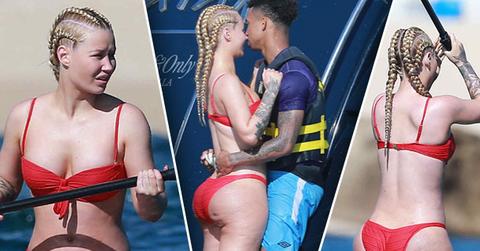 //iggy azalea plastic surgery bikini butt implant cellulite pp