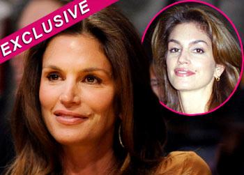 //cindy crawford injections face