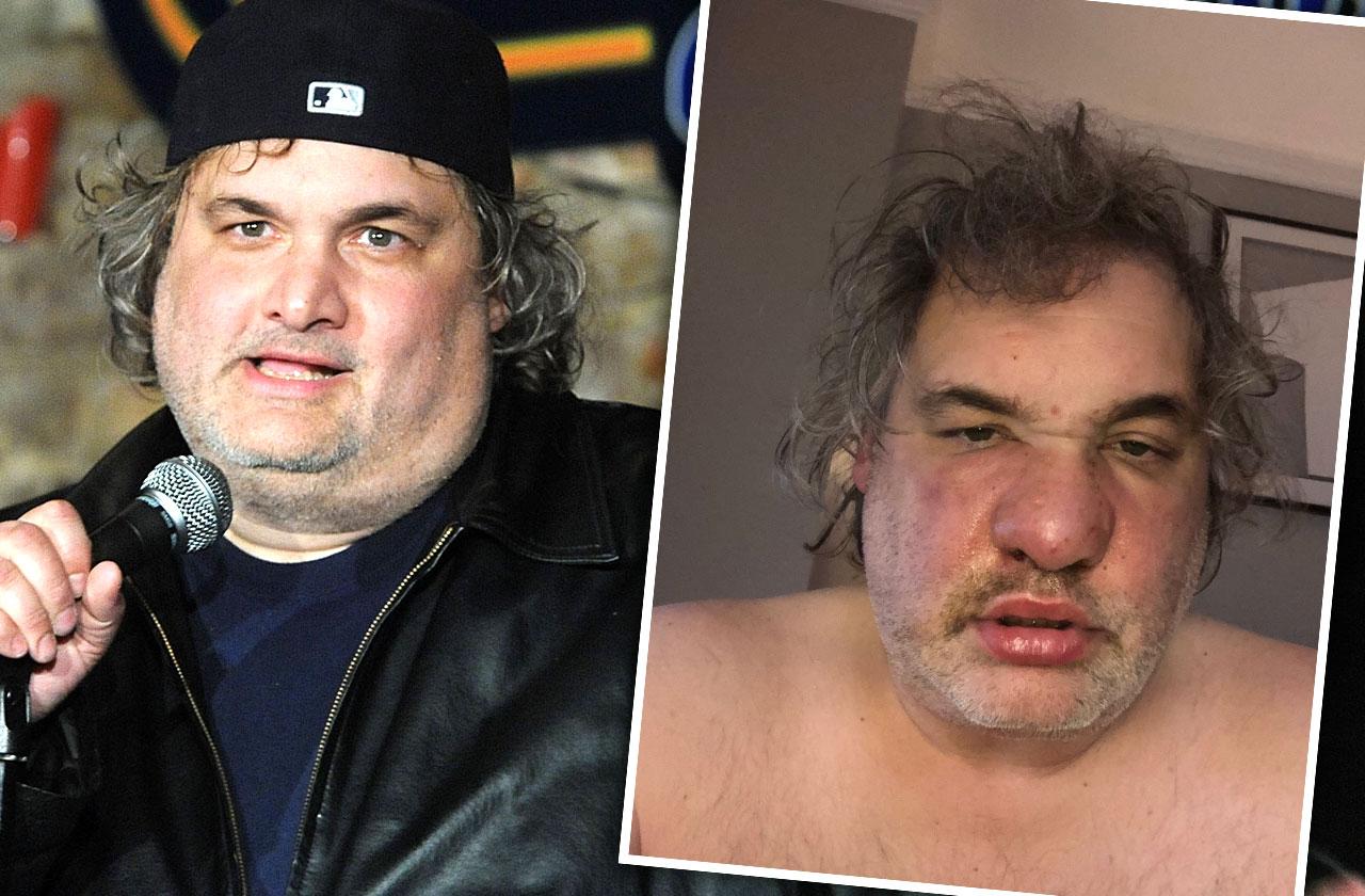 //artie lange medical leave pp