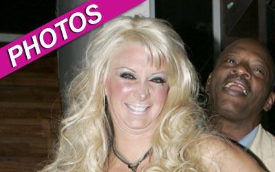 //sarah burge daughter liposuction christmas