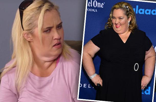 //Mama June Shannon Tummy Tuck Skin Removal Breast Lift pp