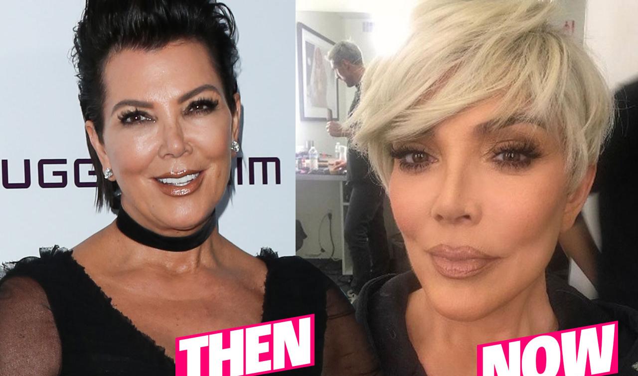 Kris Jenner Flaunts New Face After Plastic Surgery Makeover