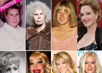 //scariest plastic surgery faces getty wenn