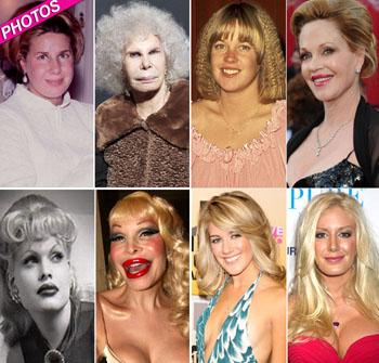 //scariest plastic surgery faces getty wenn