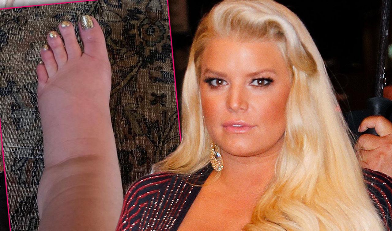 Pregnant Jessica Simpson Shocks Fans With Photo Of Swollen Foot(00)