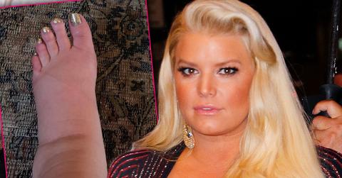 Pregnant Jessica Simpson Swollen Foot Photo