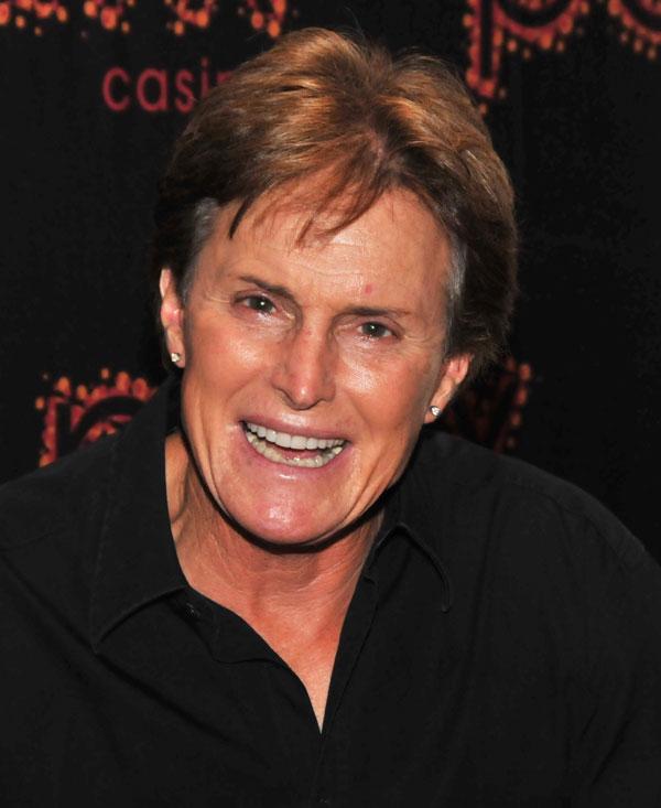 //bruce jenner sex change spent  transition hair botox fillers