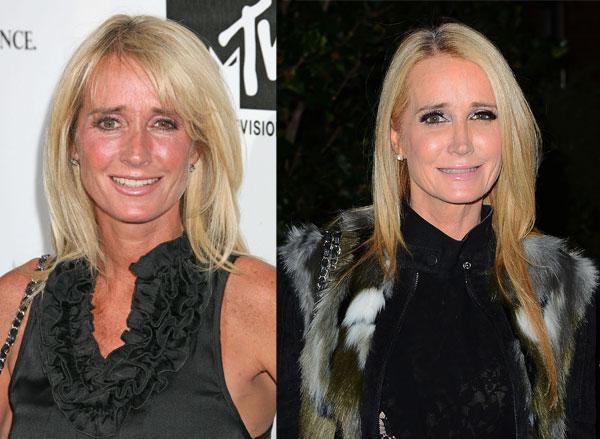 //real housewives plastic surgery secrets revealed