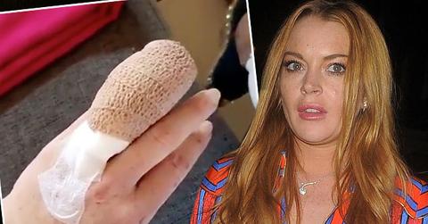 lindsay lohan finger cut off boat accident