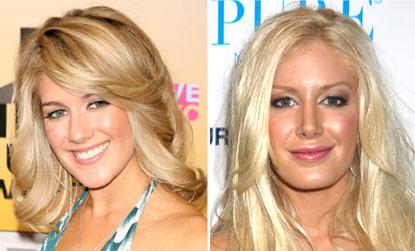 //heidi montag plastic surgery before after