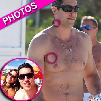 Sofia Vergara’s Boyfriend Nick Loeb Reveals Battle Scars After New Year