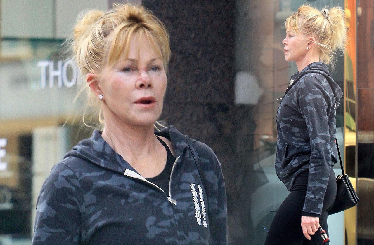 Melanie Griffith Wears Nose Bandage After Skin Cancer Treatment 