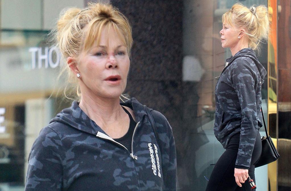 Melanie Griffith Wears Nose Bandage After Skin Cancer Treatment