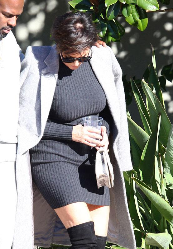 Kris Jenner Bald Spot