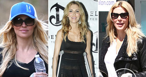 //brandi glanville injuries square splash getty pcn