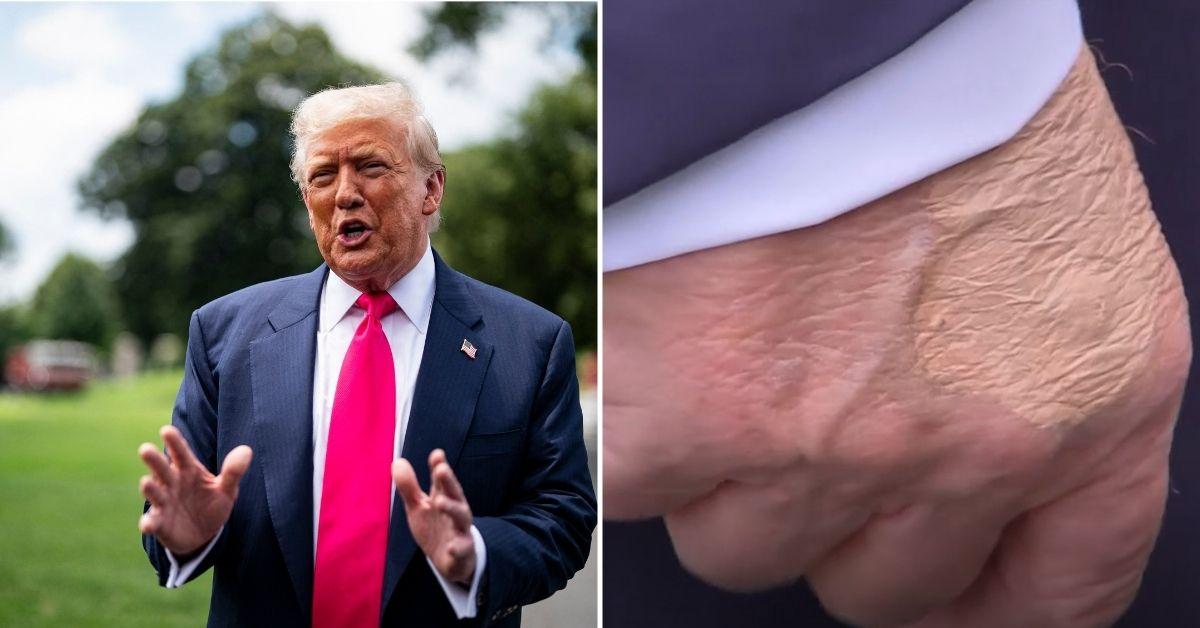 Split photo of Donald Trump and hand