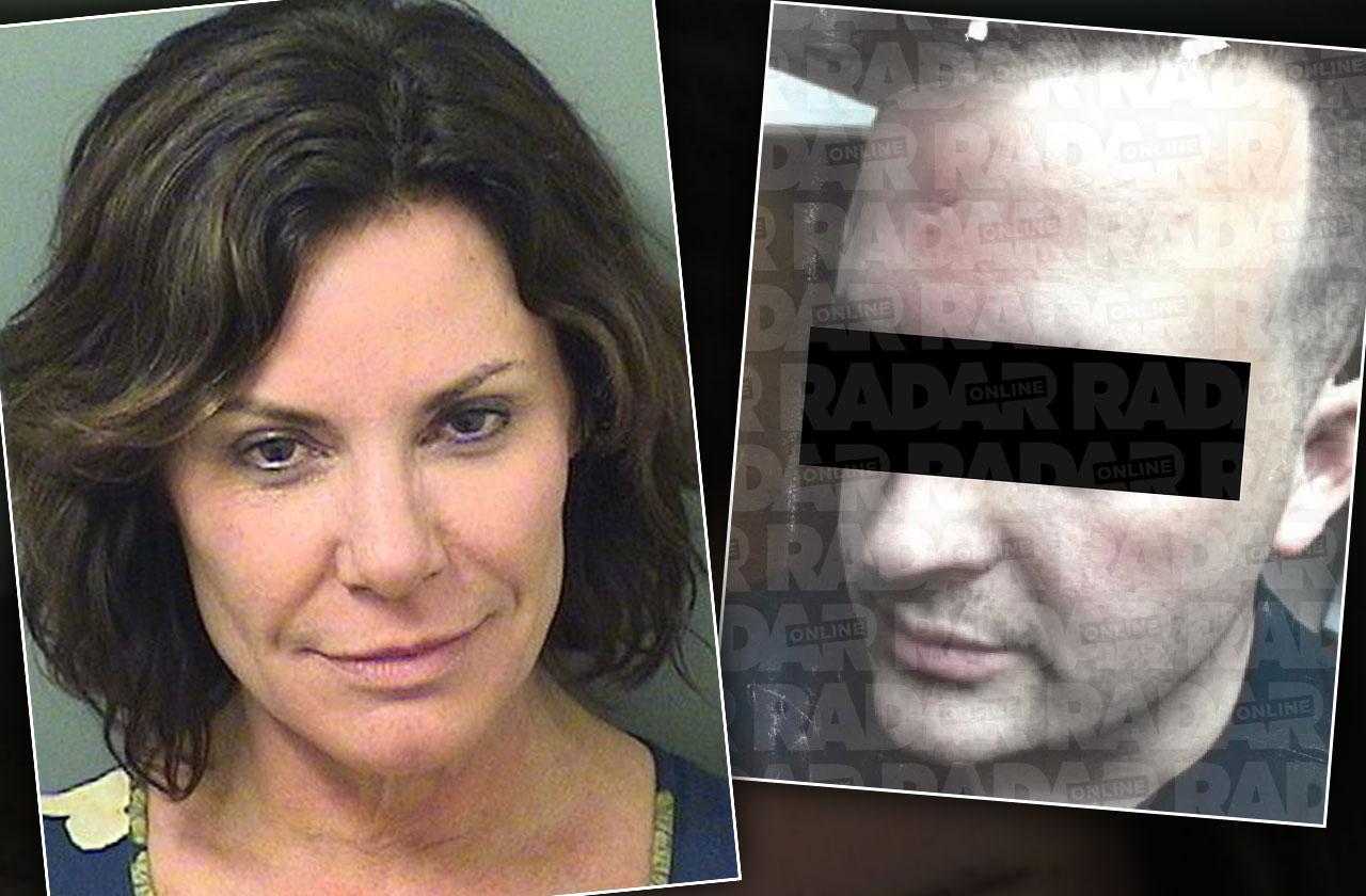 //luann de lesseps police assault bloody photos pp