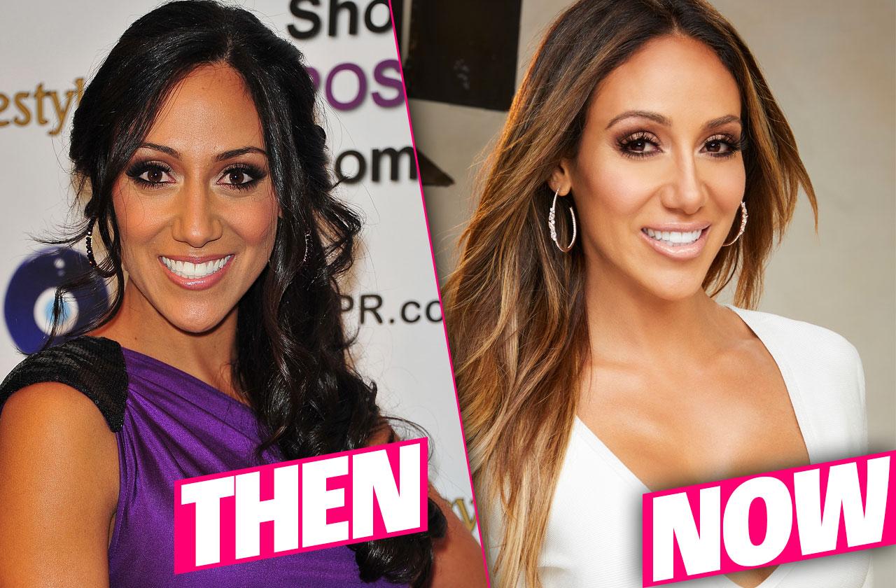 //melissa gorga plastic surgery nose job fillers boob job  pp