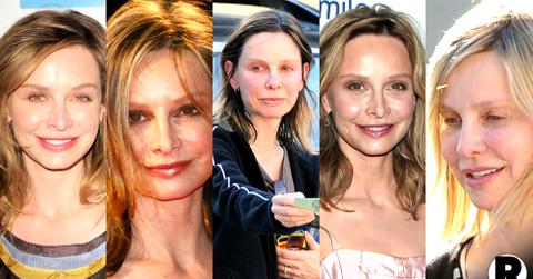 Calista Flockhart Facelift