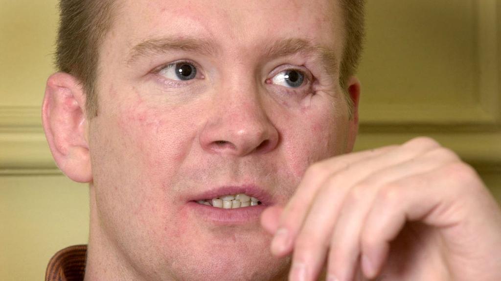 Inside Trevor Rees-jones’ 11-hour Facial Reconstruction After The Diana Crash