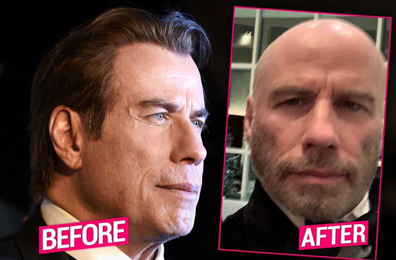 John Travolta Embraces Baldness In Revealing New Photo