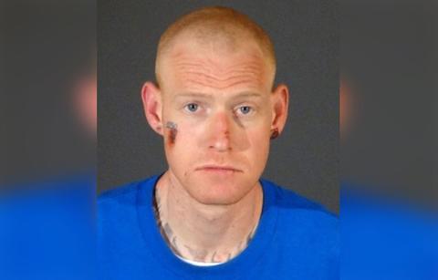 Redmond O'Neal Mugshot wering Blue shirt with Scabs on Right Cheek, Nose and Right Earlob
