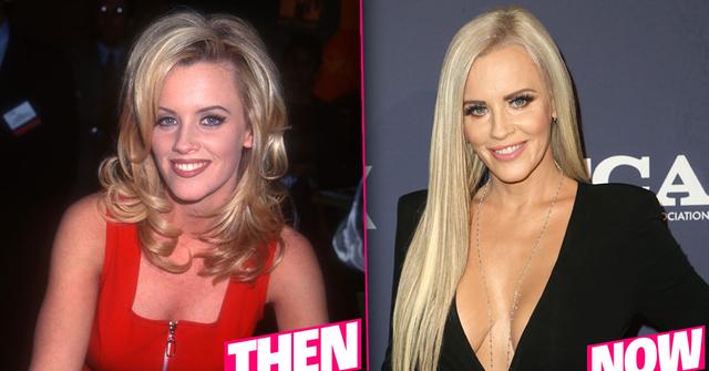 Jenny McCarthy’s Plastic Surgery History Exposed