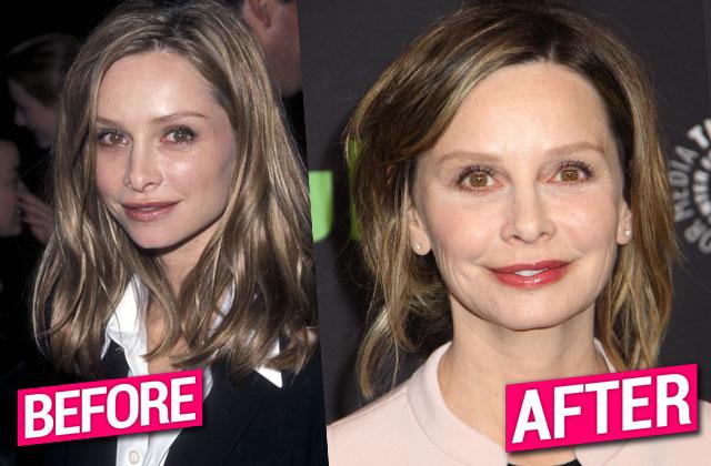 Calista Flockhart Plastic Surgery Face Weight Gain