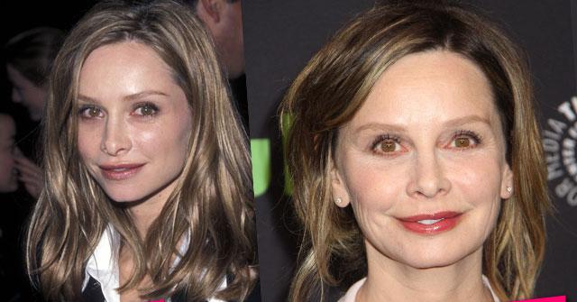 Calista Flockhart Plastic Surgery Face Weight Gain