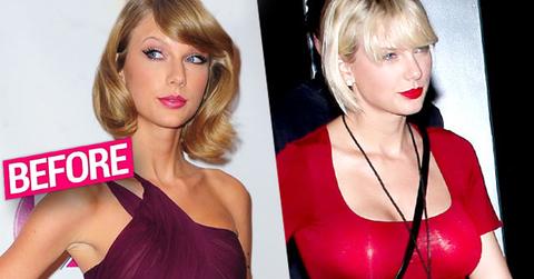 //taylor swift boob job claims doctors