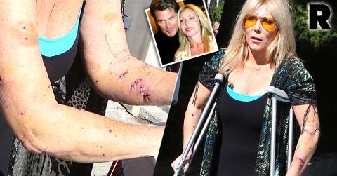 david hasselhoff ex pamela bach bulldog attack