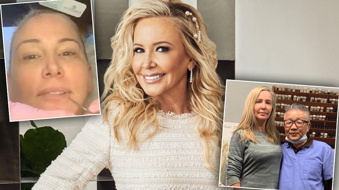 RHOC' Star Shannon Beadors Multiple Plastic Surgery Procedures Since January Facelift Revealed