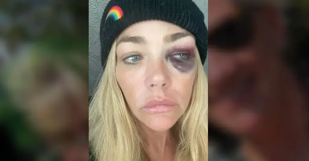 Denise Richards To Show Judge 'RHOBH' Footage In Restraining Order Bid