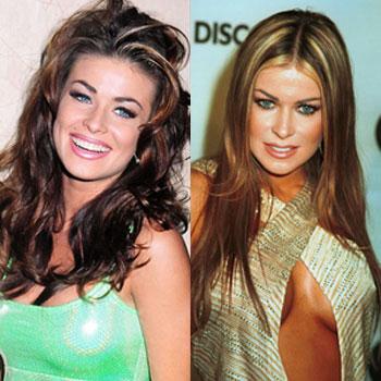 Plastic Surgery Gone Wrong: Celebs Who Regret Going Under the Knife and  Other Cosmetic Procedures