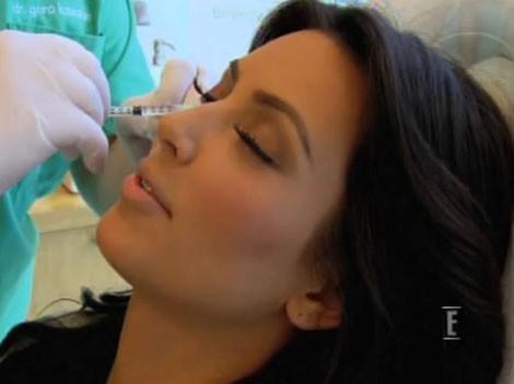 //video kim kardashian se fait injecter du botox devant les cameras regardez_image_article_paysage_new