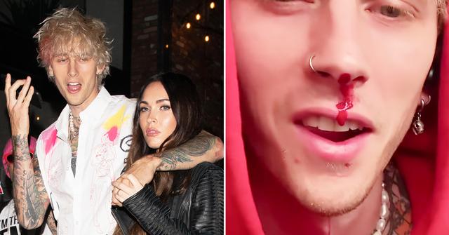 megan fox boyfriend machine gun kelly bloody nose punches fan louder than life r