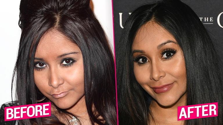 'Jersey Shore' Cast's Shocking Plastic Surgery Transformations Revealed