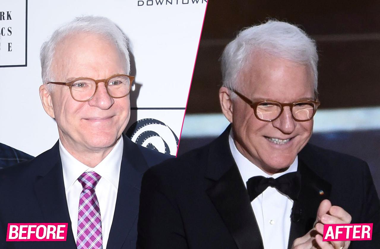 Laugh Lines? Leading Plastic Surgeons Break Down Comedian Steve Martin’s Secrets To His Youthful Look at 74